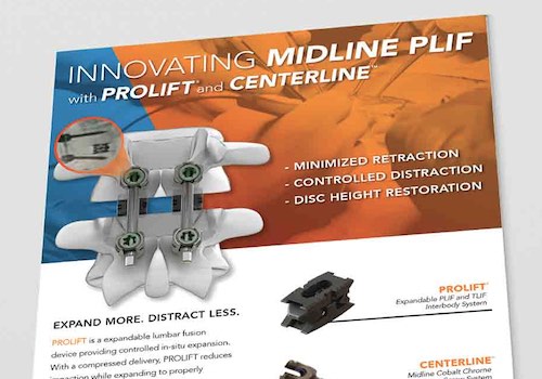 MUSE Advertising Awards - Innovating Midline PLIF Spine Procedures