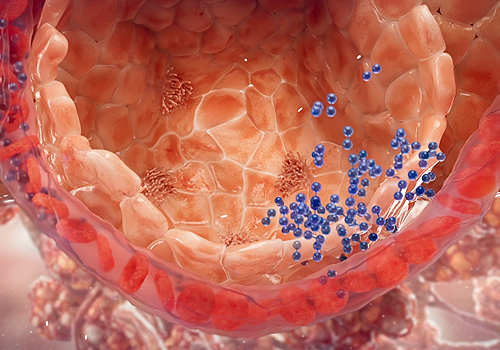 MUSE Winner - Vantive ECCO2R Mechanism of Action